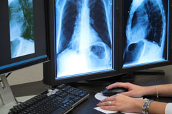 Find the best per read rate for your radiology needs - Free Quotes and Top-Rated Service
